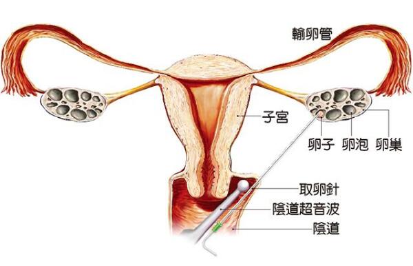 怀孕试纸