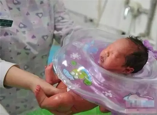 助孕